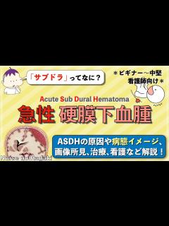 [x]【急性硬膜下血腫とは？】ASDHの原因や病態イメージ､画像所見､治療､看護などを解説！ - YouTube