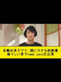 [x]有働由美子アナ、顔に大きな絆創膏 痛々しい姿でnews zero生出演 - YouTube