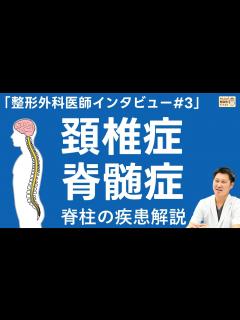 [x]「整形外科医師インタビュー#5」脊柱の疾患解説 ～頚椎症性脊髄症～【埼玉石心会病院】 - YouTube