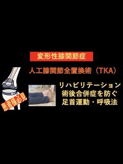 [x]人工膝関節全置換術（TKA）術後のリハビリテーション-術後合併症を防ぐための運動・呼吸方法- - YouTube